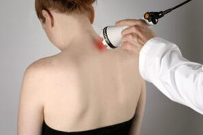 Terapia a laser